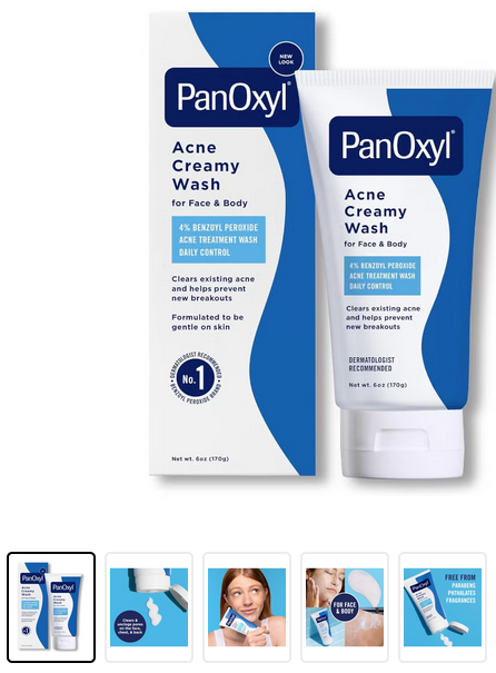 Acne Creamy Wash, 4% Benzoyl Peroxide, 6 Oz 170grams