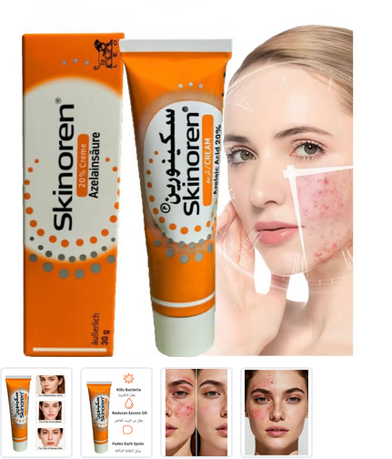 Skinoren Azelaic Acid 20% Cream - FDA Approved Acne Treatment for Pimples, Melasma & Dark Spots, with Vitamin