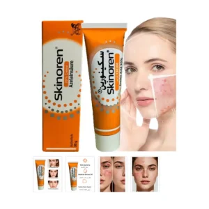L.E.O Skinoren Azelaic Acid 20% Cream - FDA Approved Acne Treatment for Pimples, Melasma & Dark Spots, with Vitamin